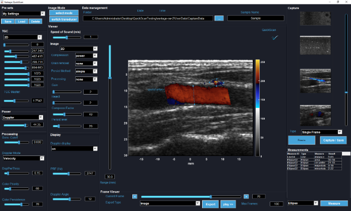 SoniVue Quickcan software