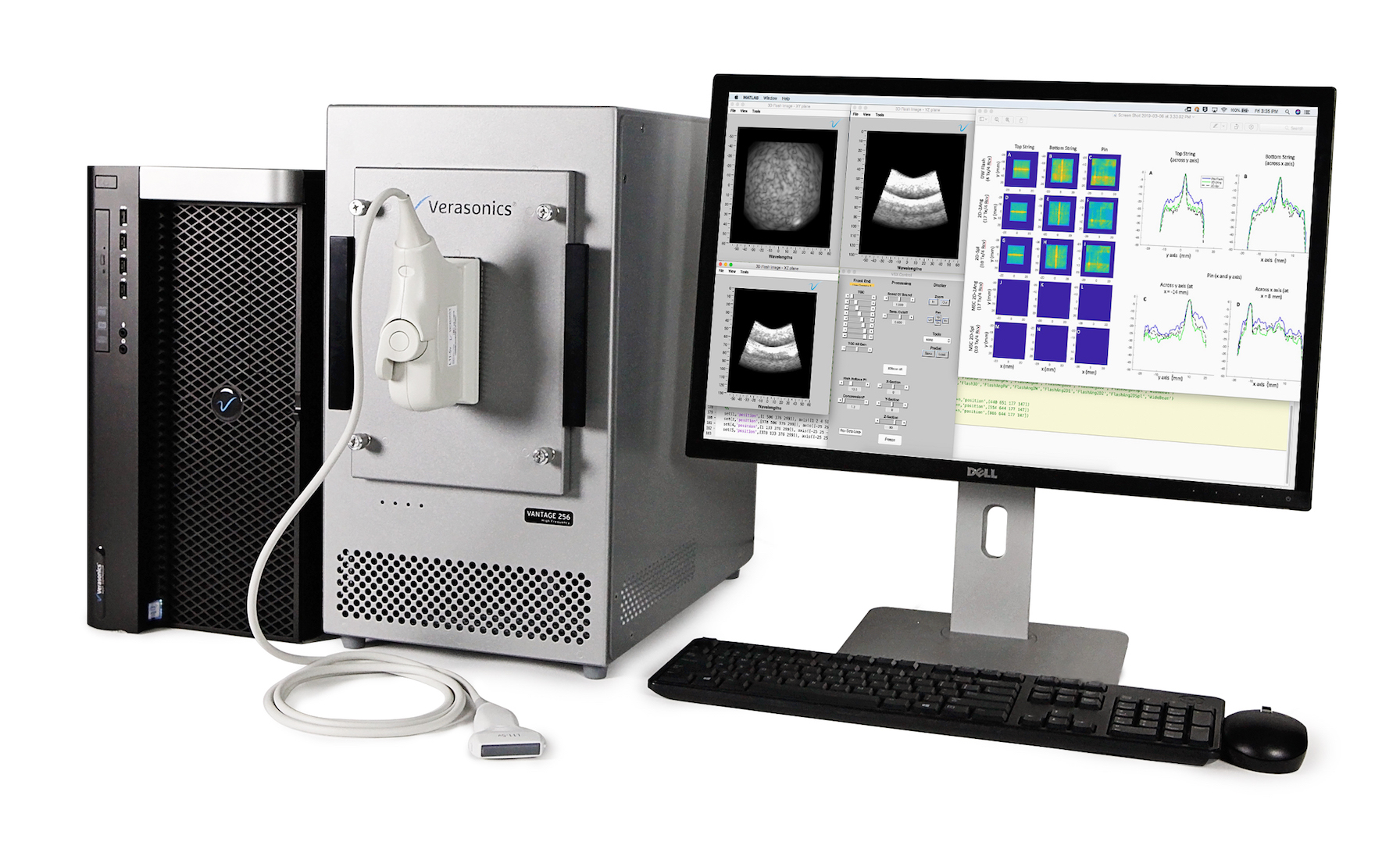 Ultrafast Ultrasound Imaging2