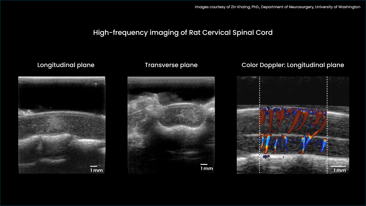 High frequency B-mode and Color Doppler images High frequency B-mode and Color Doppler images of a rat cervical spinal cord after a contusion. These images were acquired with a L35-16vX (28 MHz) transducer using the Optimized Image quality scripts