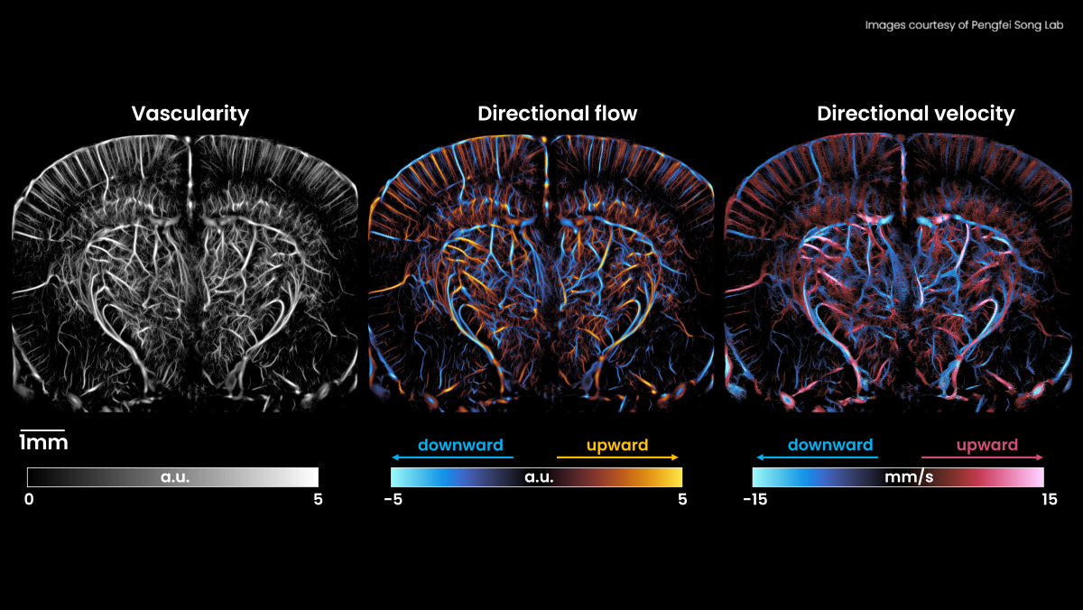 ULM L35-16vX NXT Image of a ULM on a mouse model using the L35-16vX (28 MHz) transducer. Images of Vascularity, Directional Flow and Directional Velocity
