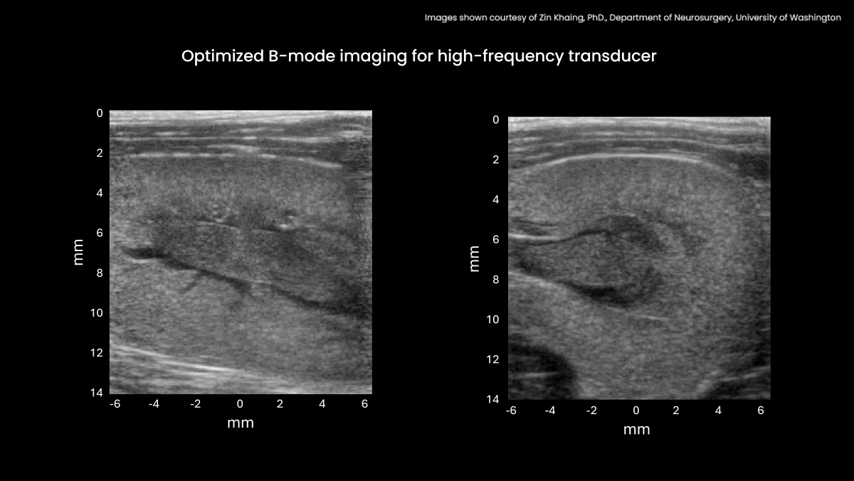 Optimized B-mode imaging for high-frequency transducer High-image quality B-mode images of a rat kidney acquired with Optimized sequences for L22-14vX (18 MHz) transducer