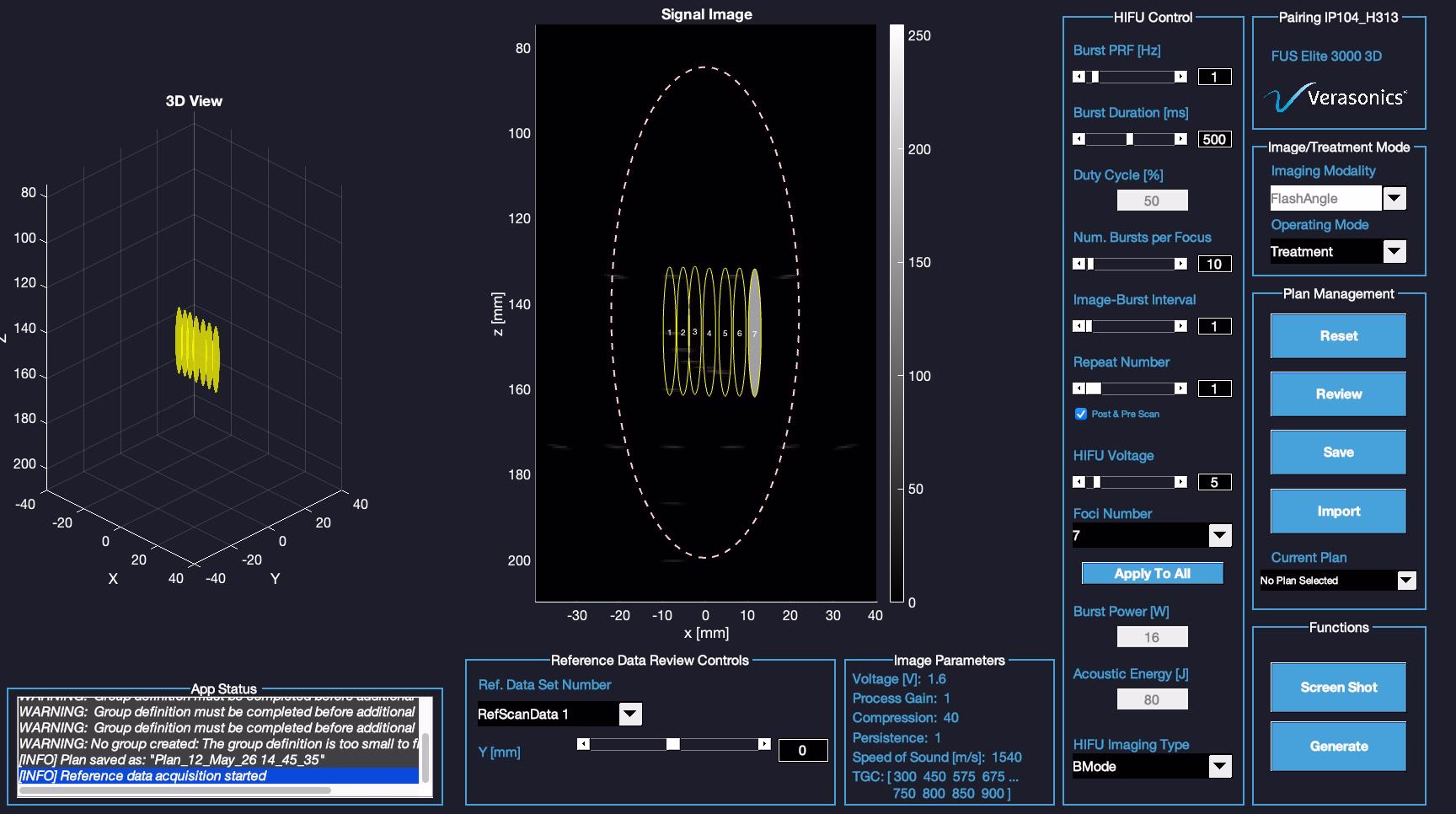 FUS 3D GUI Image of the Focused Ultrasound Elite graphical user interface for Verasonics Systems